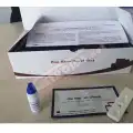COVID-19 IGG/IGM RAPID TEST CASSETTE  (KIT)